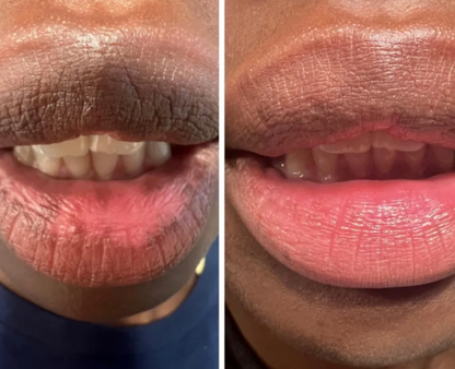 Nuvira Dark Lips Brightening Cream