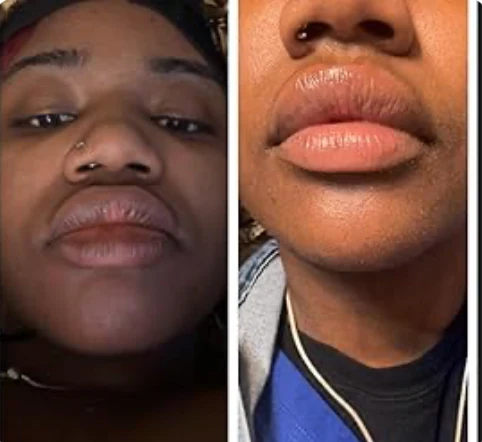 Nuvira Dark Lips Brightening Cream